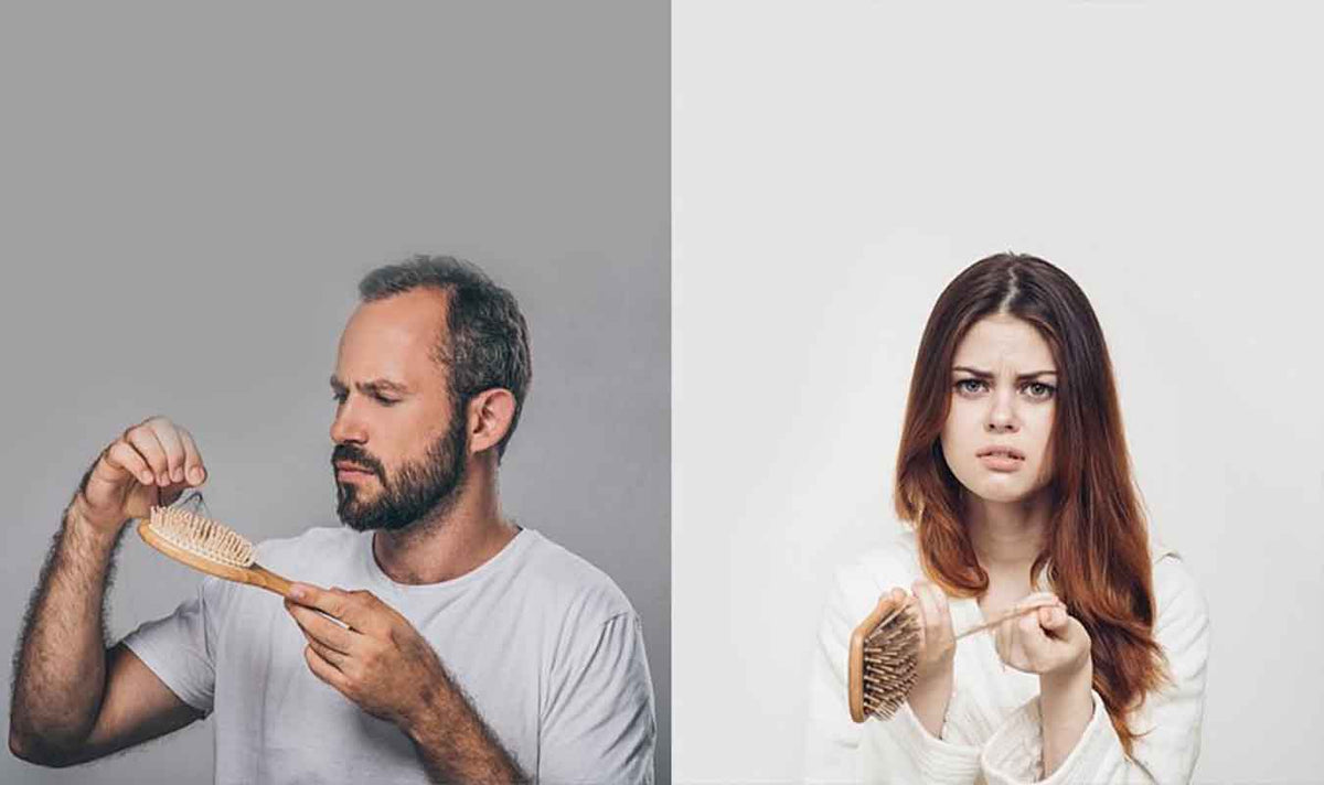 Do Men and Women experience the same type of hair loss?