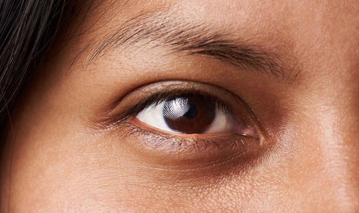 How to reduce dark circles?