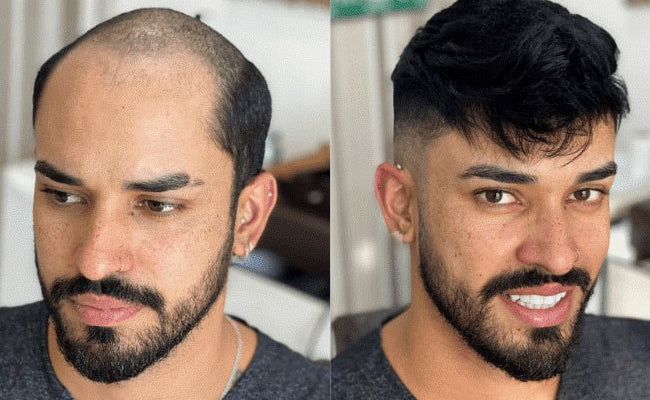 How the modern hair system works?
